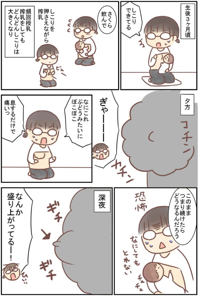 繰り返すしこり乳腺炎 漫画